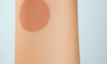 Przebarwienia pod pachami: jak rozpoznać przyczyny i skutecznie ograniczać ich powstawanie