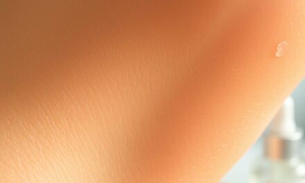 Kwas migdałowy a trądzik: jak działa, kiedy pomaga i na co zwrócić uwagę w pielęgnacji skóry trądzikowej